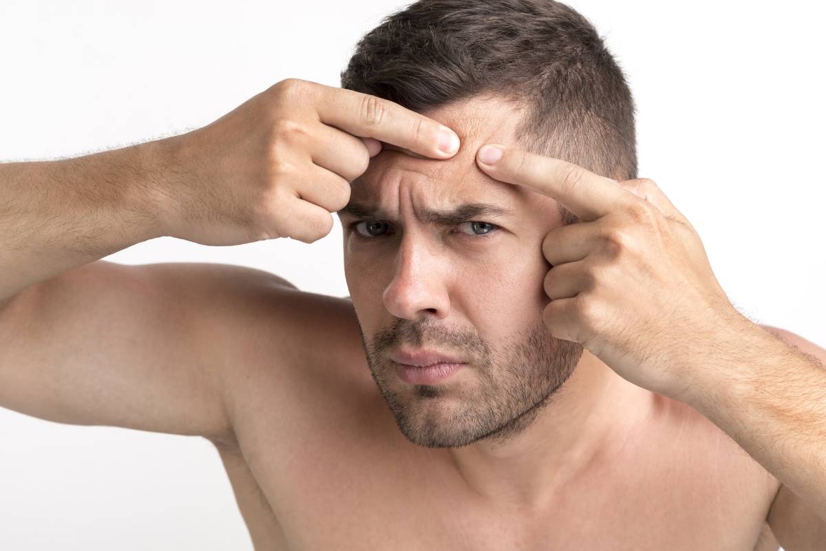 8 Essentials For Oily Skin That Every Man Should Have!