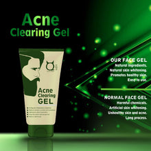 Load image into Gallery viewer, Clearing gel