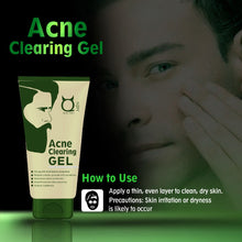 Load image into Gallery viewer, Acne Clearing Face Gel- Prevents and Clears Acne, 50g