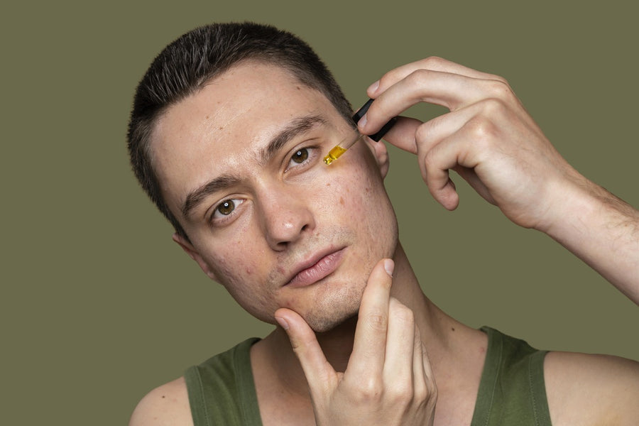 How to Treat Oily Skin