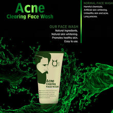 Load image into Gallery viewer, Acne Clearing Face Wash - For Acne and pimples, 100g
