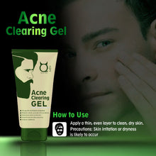 Load image into Gallery viewer, Acne Clearing Face Gel- Prevents and Clears Acne, 50g
